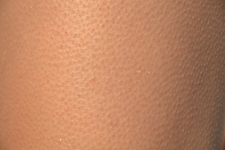 Imagen extraída de internet. 